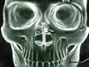 human skull xray by: muckyman